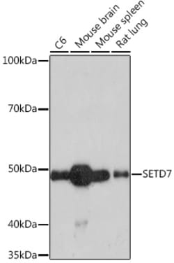 Invitrogen SETD7 Recombinant Rabbit Monoclonal Antibody (7Z6I8) 100 &mu;L | Buy Online | Invitrogen&trade; | Fisher Scientific