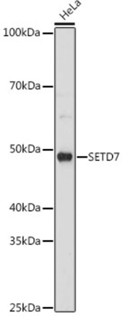 Invitrogen SETD7 Recombinant Rabbit Monoclonal Antibody (7Z6I8) 100 &mu;L | Buy Online | Invitrogen&trade; | Fisher Scientific