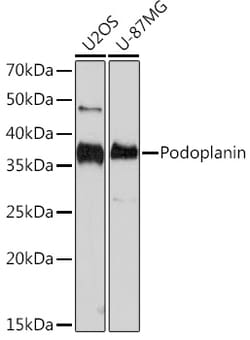 Invitrogen Podoplanin Recombinant Rabbit Monoclonal Antibody (8I3I5) 100