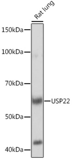 Invitrogen USP22 Recombinant Rabbit Monoclonal Antibody (9C7I8) 100 &mu;L;