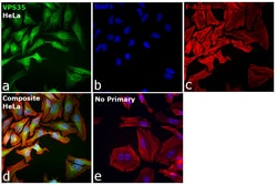 Invitrogen VPS35 Recombinant Rabbit Monoclonal Antibody (8D3L3) 100 &mu;L;