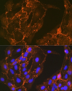 Invitrogen Cortactin Recombinant Rabbit Monoclonal Antibody (2W5H9) 100