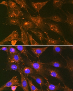 Invitrogen Cortactin Recombinant Rabbit Monoclonal Antibody (2W5H9) 100