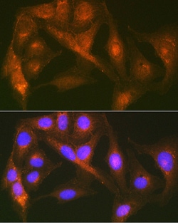 Invitrogen Cortactin Recombinant Rabbit Monoclonal Antibody (2W5H9) 100