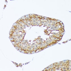 Invitrogen Cortactin Recombinant Rabbit Monoclonal Antibody (2W5H9) 100