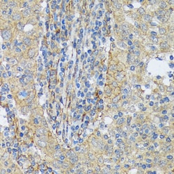 Invitrogen Cortactin Recombinant Rabbit Monoclonal Antibody (2W5H9) 100