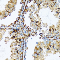 Invitrogen Cortactin Recombinant Rabbit Monoclonal Antibody (2W5H9) 100