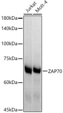 Invitrogen Zap-70 Recombinant Rabbit Monoclonal Antibody (7G0U1) 100 &mu;L;