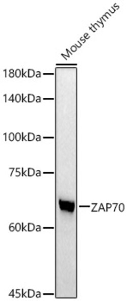 Invitrogen Zap-70 Recombinant Rabbit Monoclonal Antibody (7G0U1) 100 &mu;L;