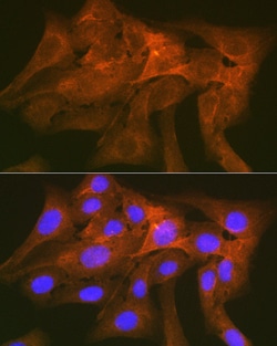 Invitrogen SIRP alpha Recombinant Rabbit Monoclonal Antibody (10Q7E6) 100
