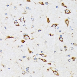 Invitrogen RPS20 Recombinant Rabbit Monoclonal Antibody (9H1D4) 100 &mu;L;