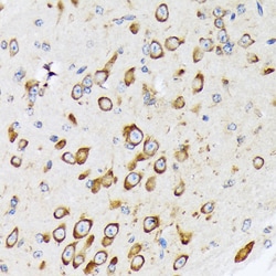 Invitrogen RPS20 Recombinant Rabbit Monoclonal Antibody (9H1D4) 100 &mu;L;