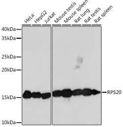 Invitrogen RPS20 Recombinant Rabbit Monoclonal Antibody (9H1D4) 100 &mu;L;