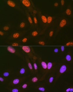 Invitrogen HIPK2 Recombinant Rabbit Monoclonal Antibody (3Z5P6) 100 &mu;L;