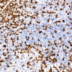 Invitrogen CD7 Recombinant Rabbit Monoclonal Antibody (9R10T5) 100 &mu;L;