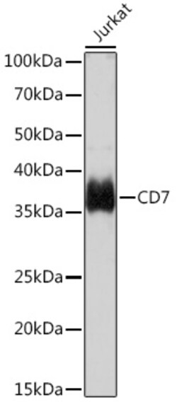 Invitrogen CD7 Recombinant Rabbit Monoclonal Antibody (9R10T5) 100 &mu;L;
