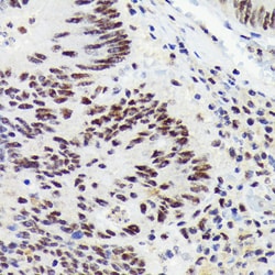 Invitrogen RNF40 Recombinant Rabbit Monoclonal Antibody (8I7R5) 100 &mu;L;