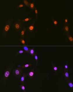 Invitrogen HnRNP Q Recombinant Rabbit Monoclonal Antibody (1R0G5) 100 &mu;L | Buy Online | Invitrogen&trade; | Fisher Scientific