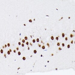 Invitrogen HnRNP Q Recombinant Rabbit Monoclonal Antibody (1R0G5) 100 &mu;L | Buy Online | Invitrogen&trade; | Fisher Scientific