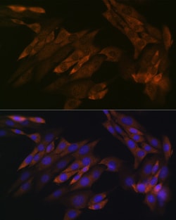 Invitrogen DDX6 Recombinant Rabbit Monoclonal Antibody (6F9I6) 100 &mu;L;
