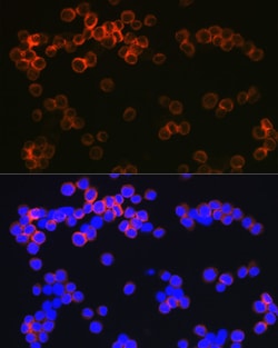 Invitrogen DC-SIGN Recombinant Rabbit Monoclonal Antibody (5C8C7) 100 &mu;L;
