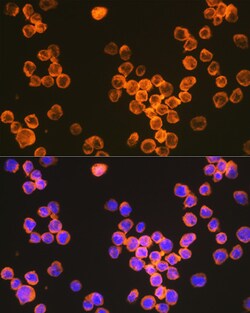 Invitrogen DC-SIGN Recombinant Rabbit Monoclonal Antibody (5C8C7) 100 &mu;L;