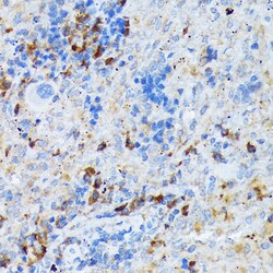 Invitrogen DC-SIGN Recombinant Rabbit Monoclonal Antibody (5C8C7) 100 &mu;L;