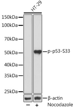 Invitrogen Phospho-p53 (Ser33) Recombinant Rabbit Monoclonal Antibody (2Y4T8)