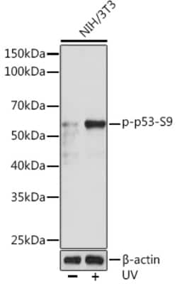 Invitrogen Phospho-p53 (Ser9) Recombinant Rabbit Monoclonal Antibody (10U5R6)
