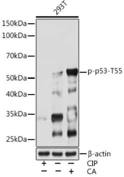 Invitrogen Phospho-p53 (Thr55) Recombinant Rabbit Monoclonal Antibody (7I0A7)