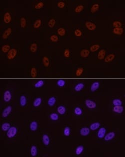 Invitrogen Phospho-POLR2A (Ser5) Recombinant Rabbit Monoclonal Antibody (10C7U2) 100 &mu;L | Buy Online | Invitrogen&trade; | Fisher Scientific