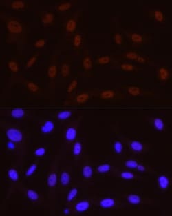 Invitrogen Phospho-POLR2A (Ser5) Recombinant Rabbit Monoclonal Antibody (10C7U2) 100 &mu;L | Buy Online | Invitrogen&trade; | Fisher Scientific