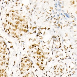 Invitrogen Phospho-POLR2A (Ser5) Recombinant Rabbit Monoclonal Antibody (10C7U2) 100 &mu;L | Buy Online | Invitrogen&trade; | Fisher Scientific