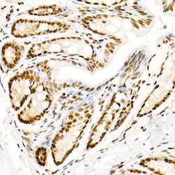 Invitrogen Phospho-POLR2A (Ser5) Recombinant Rabbit Monoclonal Antibody (10C7U2) 100 &mu;L | Buy Online | Invitrogen&trade; | Fisher Scientific