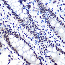 Invitrogen Phospho-IkB alpha (Ser36) Recombinant Rabbit Monoclonal Antibody