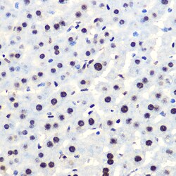 Invitrogen Phospho-IkB alpha (Ser36) Recombinant Rabbit Monoclonal Antibody
