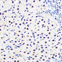 Invitrogen Phospho-IkB alpha (Ser36) Recombinant Rabbit Monoclonal Antibody