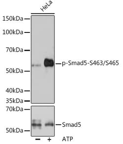 Invitrogen Phospho-Smad5 (Ser463,Ser465) Recombinant Rabbit Monoclonal
