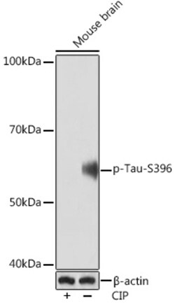 Invitrogen Phospho-Tau (Ser396) Recombinant Rabbit Monoclonal Antibody (5M1O6) 100 &mu;L | Buy Online | Invitrogen&trade; | Fisher Scientific