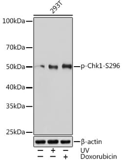 Invitrogen Phospho-Chk1 (Ser296) Recombinant Rabbit Monoclonal Antibody