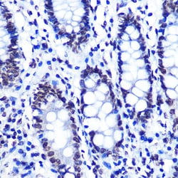 Invitrogen Phospho-SMC1 (Ser957) Recombinant Rabbit Monoclonal Antibody