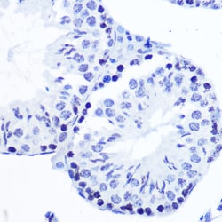 Invitrogen Phospho-SMC1 (Ser957) Recombinant Rabbit Monoclonal Antibody