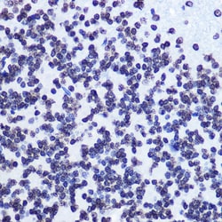 Invitrogen Phospho-SMC1 (Ser957) Recombinant Rabbit Monoclonal Antibody
