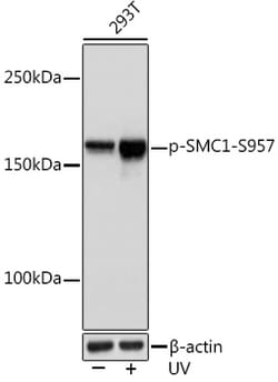 Invitrogen Phospho-SMC1 (Ser957) Recombinant Rabbit Monoclonal Antibody