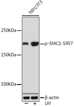 Invitrogen Phospho-SMC1 (Ser957) Recombinant Rabbit Monoclonal Antibody