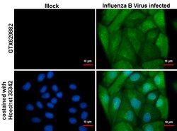 Invitrogen Influenza B NP Monoclonal Antibody (GT371) 100 &mu;L; Unconjugated:Antibodies,