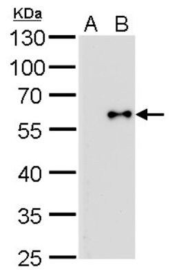 Invitrogen Influenza B NP Monoclonal Antibody (GT371) 100 &mu;L; Unconjugated:Antibodies,