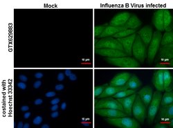 Invitrogen Influenza B NP Monoclonal Antibody (GT382) 100 &mu;L; Unconjugated:Antikörper