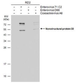 Invitrogen Enterovirus 71 3D Monoclonal Antibody (4) 100 &mu;L | Buy Online | Invitrogen&trade; | Fisher Scientific