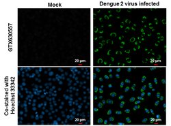 Invitrogen Dengue Virus Type 2 NS1 Monoclonal Antibody (GT1061) 100 &mu;L | Buy Online | Invitrogen&trade; | Fisher Scientific